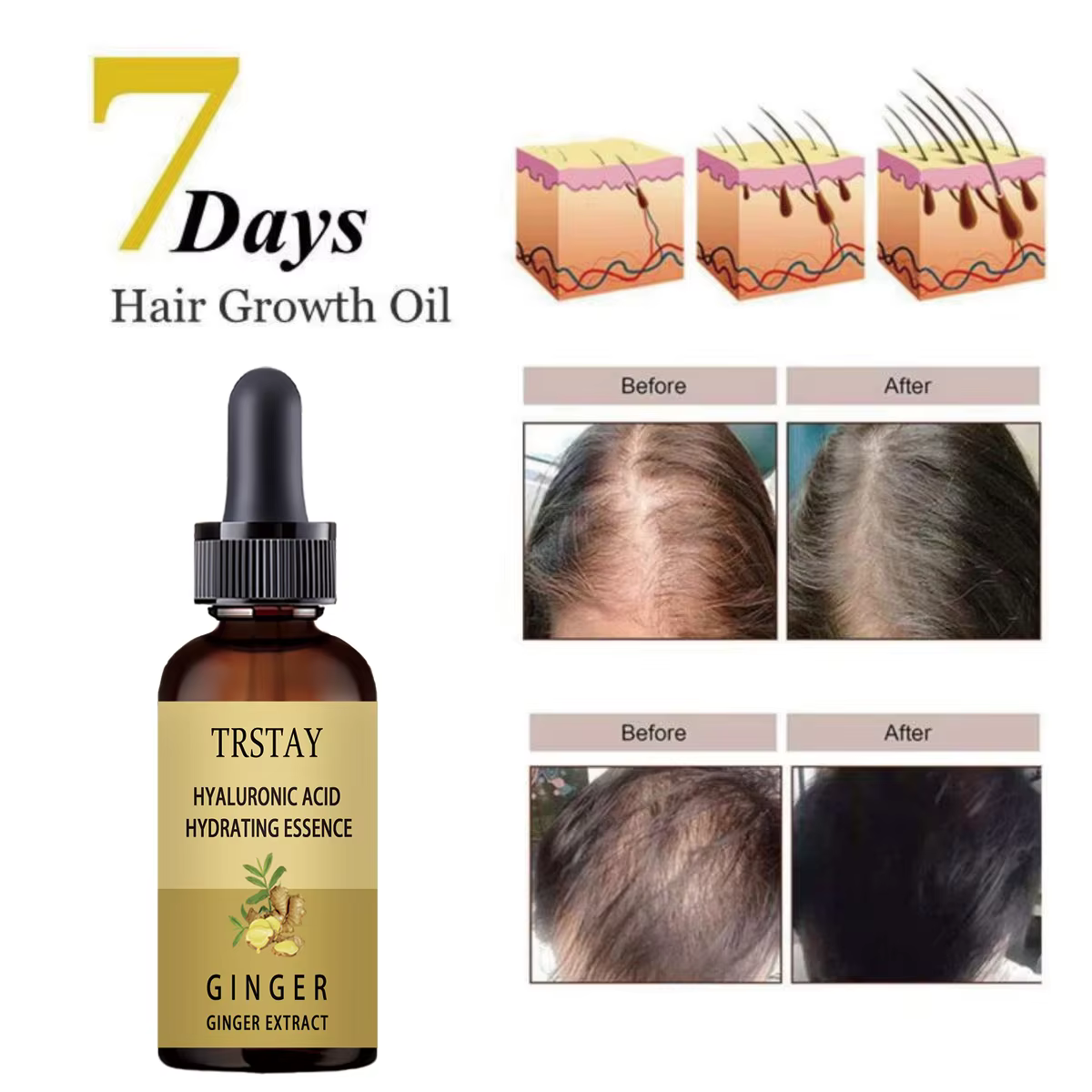 Sérum de croissance des cheveux