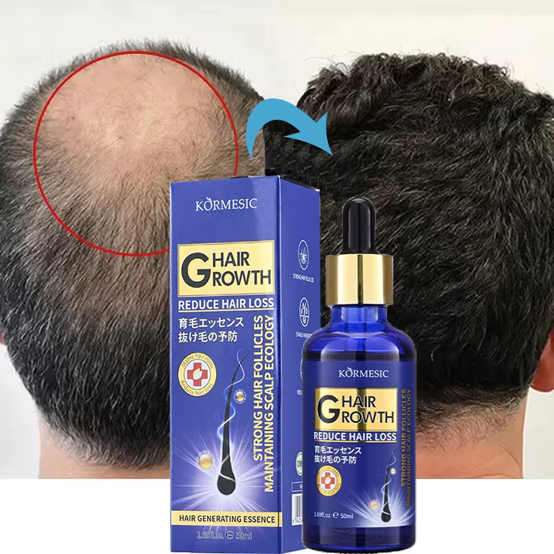 Sérum de croissance des cheveux